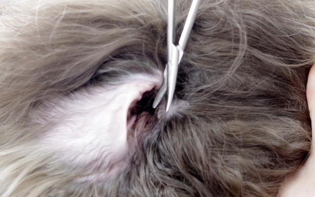 耳の中の毛の処理